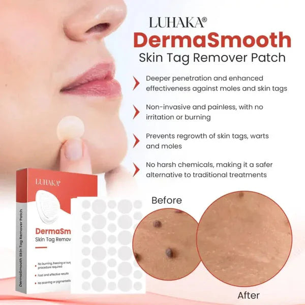 Derma Smooth™ Skin Tag Removal Patch – 100% Results, Painless & Fast