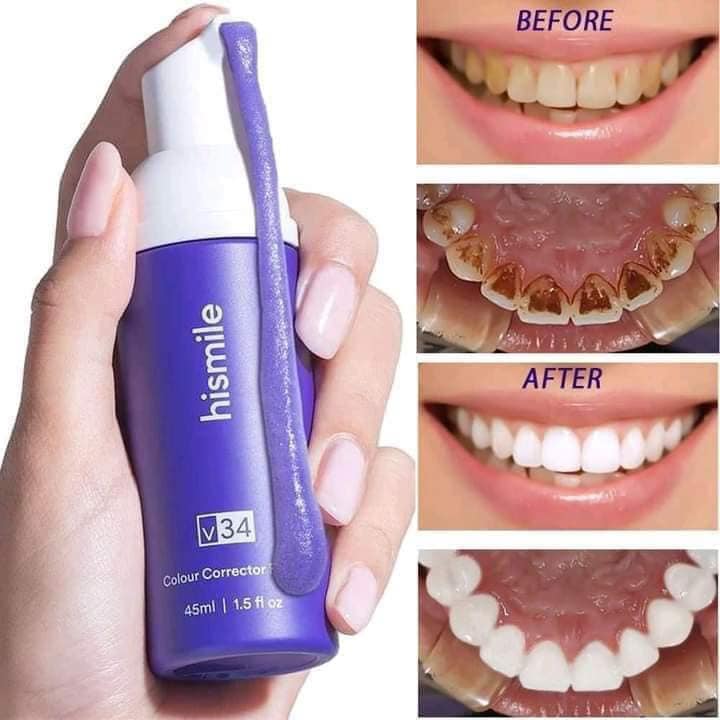 HISMILE V34 Purple Toothpaste – Deep Smoke Stain Remover & Gum Protection