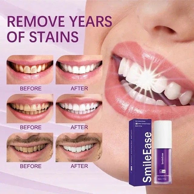 HISMILE V34 Purple Toothpaste – Deep Smoke Stain Remover & Gum Protection