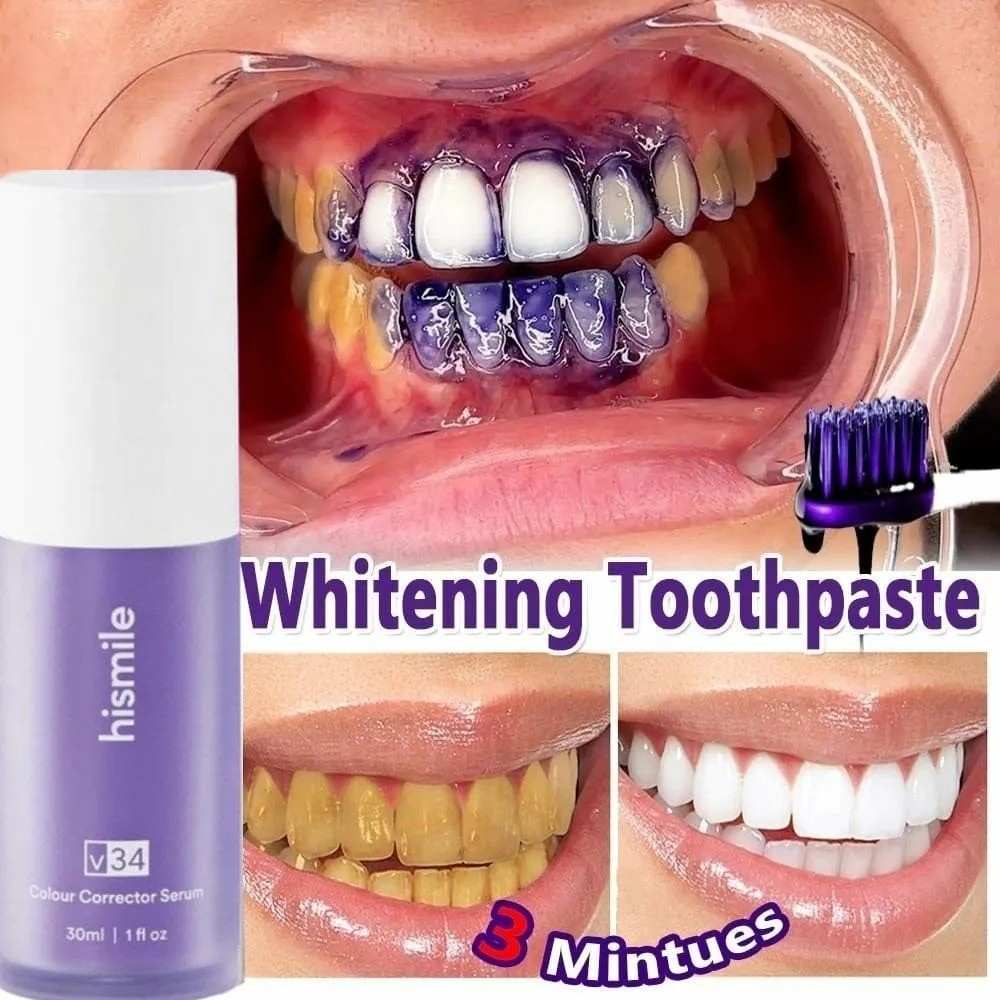HISMILE V34 Purple Toothpaste – Deep Smoke Stain Remover & Gum Protection