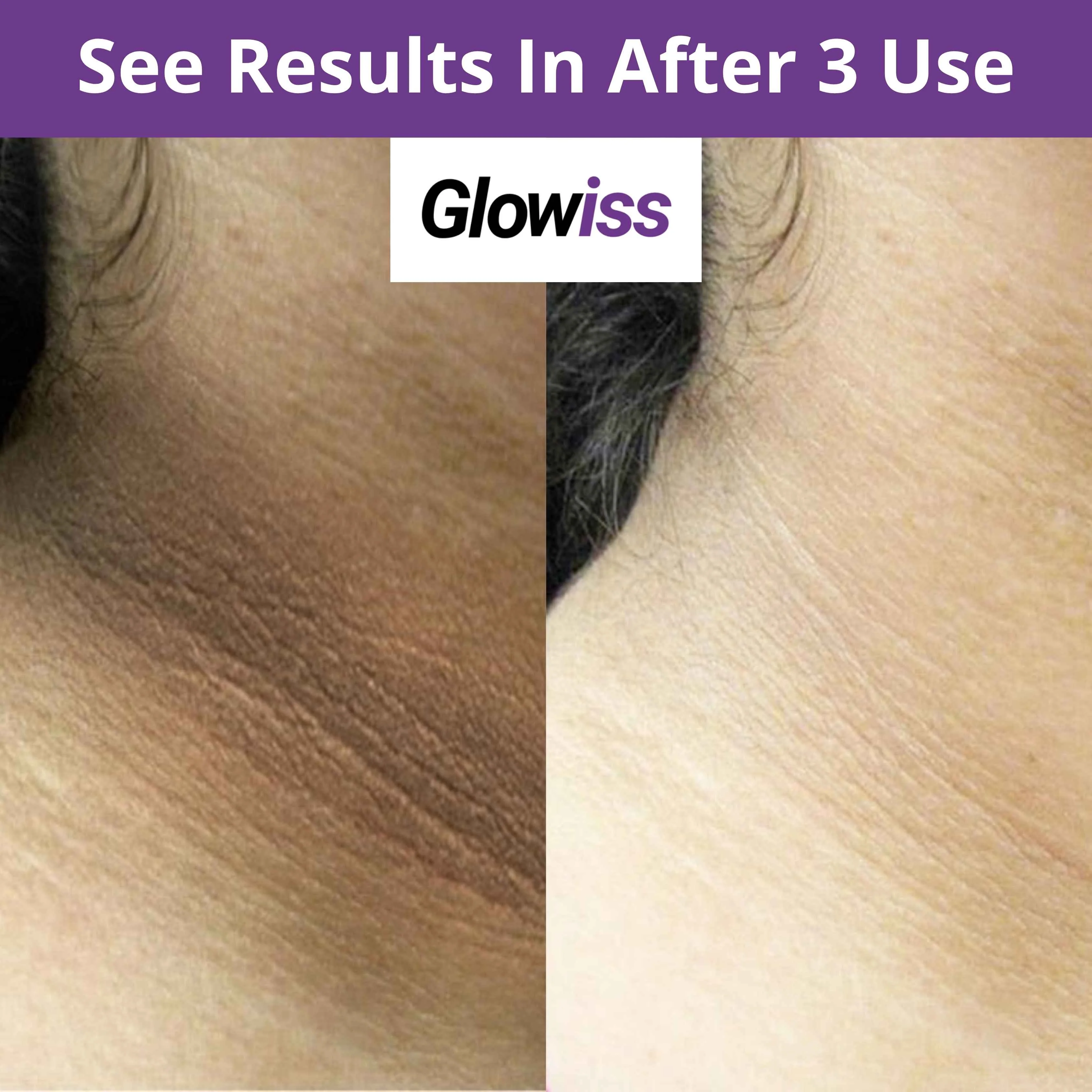 Orange Zyme Deep Clean Gel – Soft & Bright Skin Solution